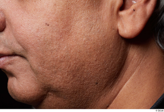 HD Face Skin John Deery cheek chin ear face skin…